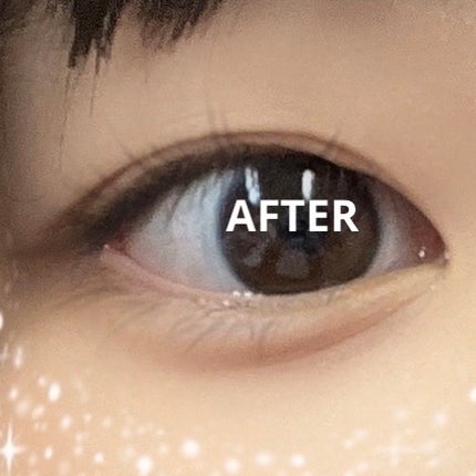 りそうのふたえ 埋没式くっきり形成/DAISO/二重まぶた用アイテムを使ったクチコミ(4枚目)