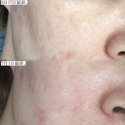 パンテショット675/COSNORI/美容液を使ったクチコミ(4枚目)