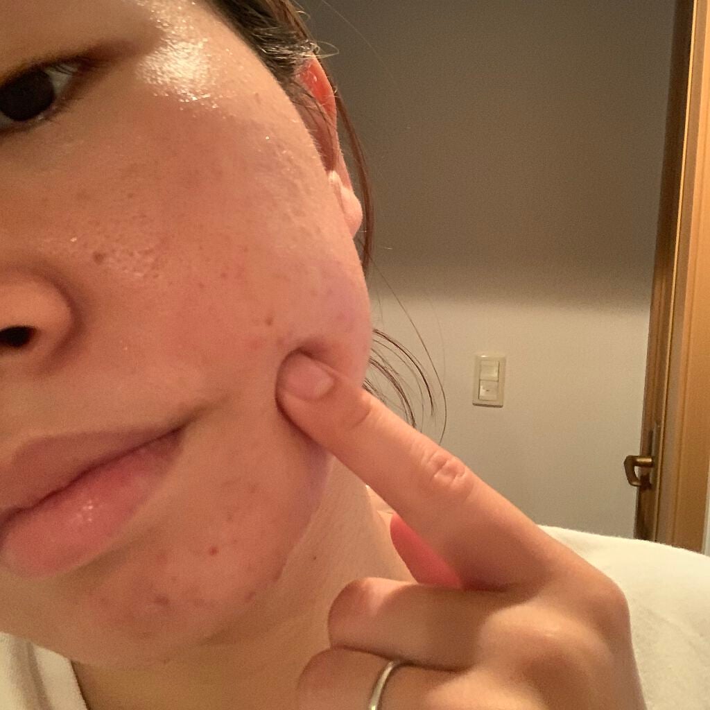 乳液/2e/乳液を使ったクチコミ(5枚目)