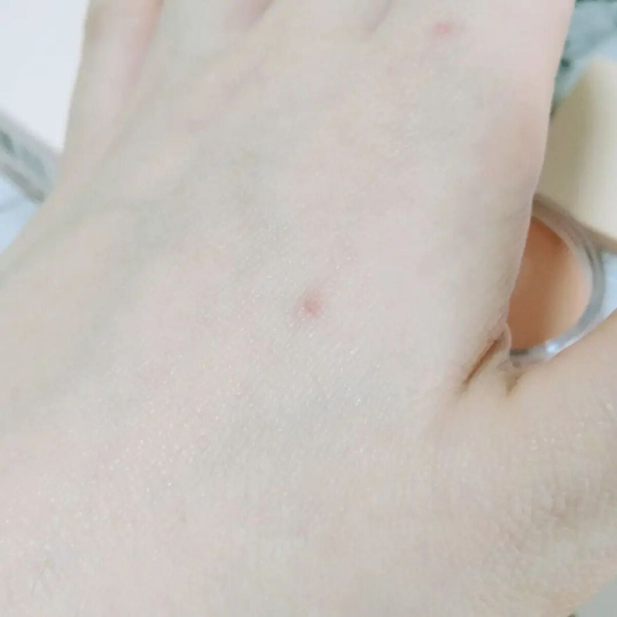 コンシールポット/LUNA/クリームコンシーラーを使ったクチコミ(4枚目)