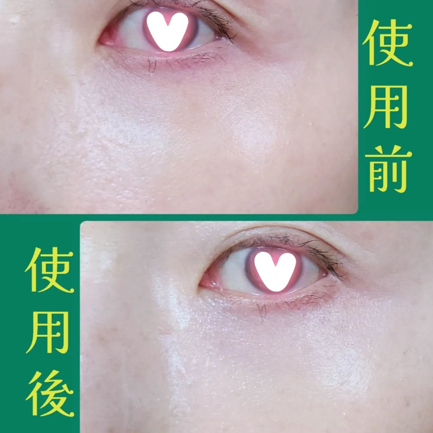 クマシーラークリーム/スキンヒーロー/アイケア・アイクリームを使ったクチコミ(10枚目)