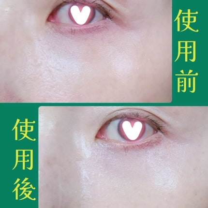 クマシーラークリーム/スキンヒーロー/アイケア・アイクリームを使ったクチコミ(10枚目)