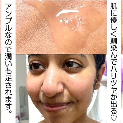 BHA ピーリングアンプル/beplain/美容液を使ったクチコミ(5枚目)