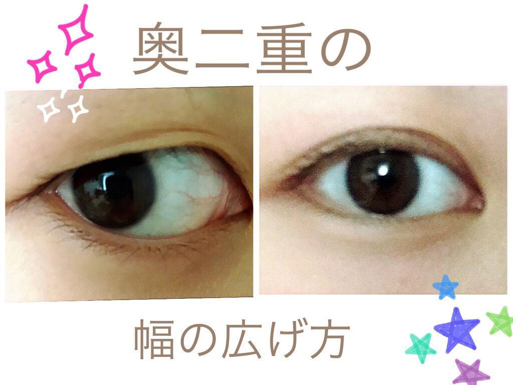 オリシキ アイリッドスキンフィルム		/D-UP/二重まぶた用アイテムを使ったクチコミ（1枚目）