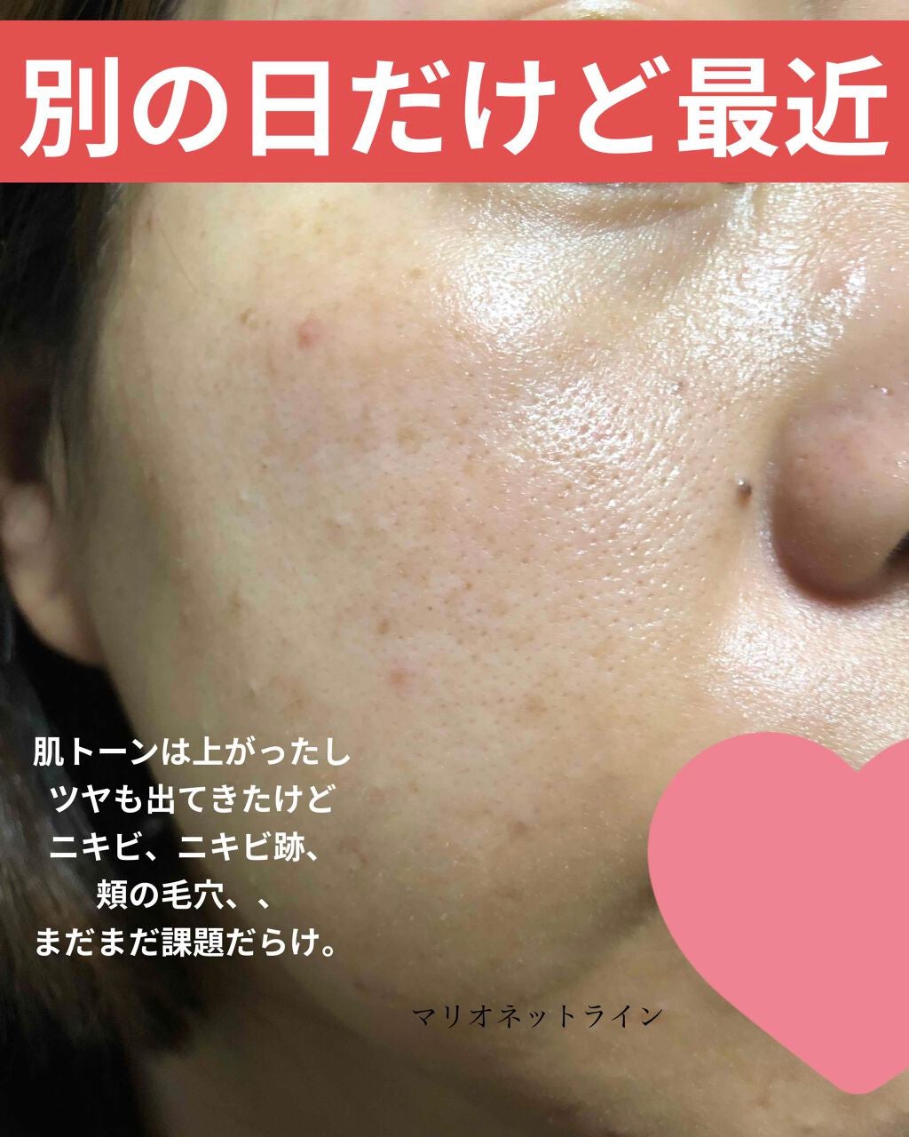 UVローション SPF50+/キュレル/日焼け止め・UVケアを使ったクチコミ(6枚目)