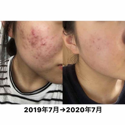 ハトムギ保湿ジェル(ナチュリエ スキンコンディショニングジェル)/ナチュリエ/美容液を使ったクチコミ(1枚目)