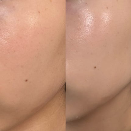 ヒアルーシカ ウォーターフィット サンセラム/SKIN1004/日焼け止めローションを使ったクチコミ(3枚目)