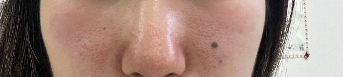 ビタペアC ダークスポットセラム/ネイチャーリパブリック/美容液を使ったクチコミ（3枚目）