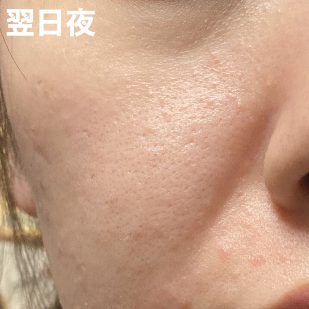 菊正宗 日本酒のクリーム/菊正宗/ボディクリームを使ったクチコミ（3枚目）