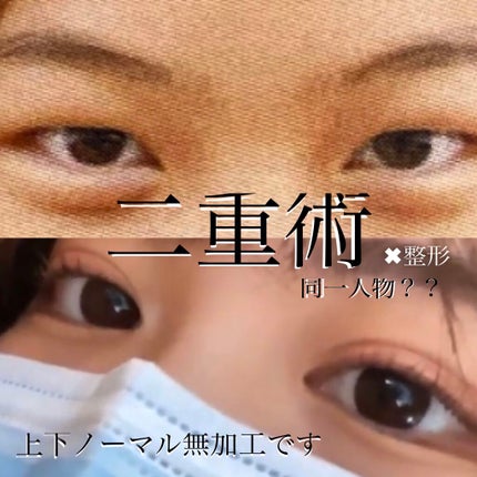 アイトーク/アイトーク/二重まぶた用アイテムを使ったクチコミ(1枚目)