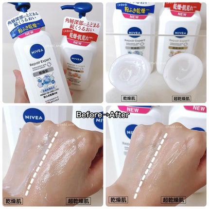 ニベア リペアエキスパート 薬用ボディミルク 乾燥肌用/ニベア/ボディミルクを使ったクチコミ(5枚目)