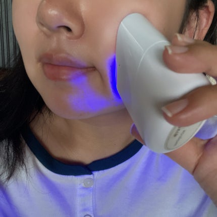 スキンライトセラピーII/Makeon/美顔器・マッサージを使ったクチコミ(6枚目)