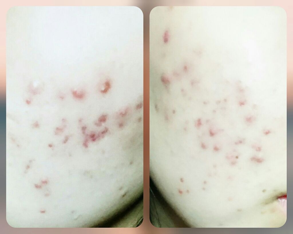 深肌水/深肌水/化粧水を使ったクチコミ（2枚目）