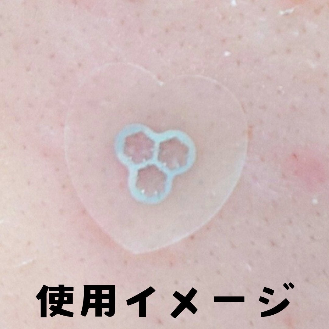 ACマグネシウムパッチ ミニ/スノーツープラス/にきびパッチを使ったクチコミ(5枚目)