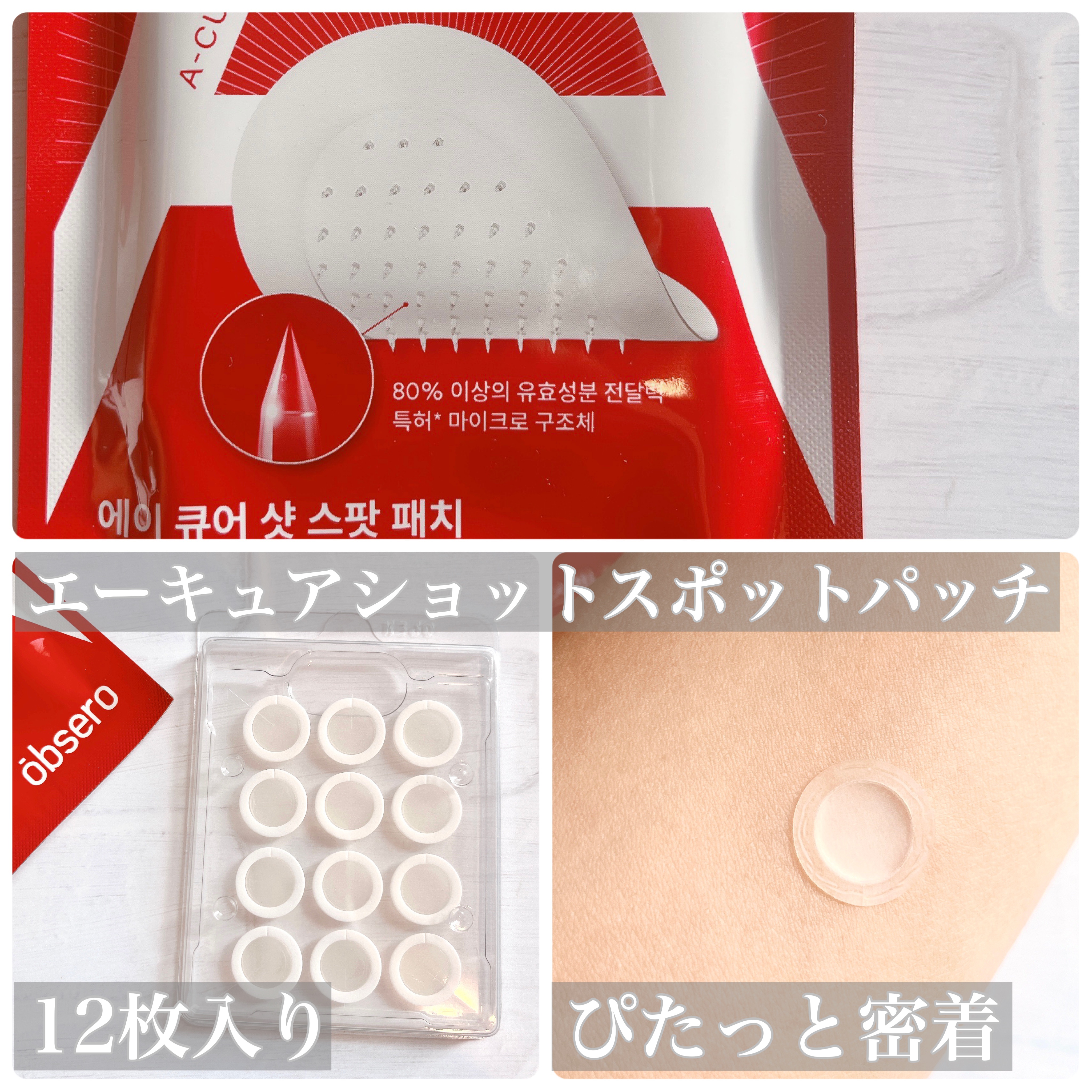 エーキュアショットスポットパッチ/obsero/にきびパッチを使ったクチコミ（2枚目）