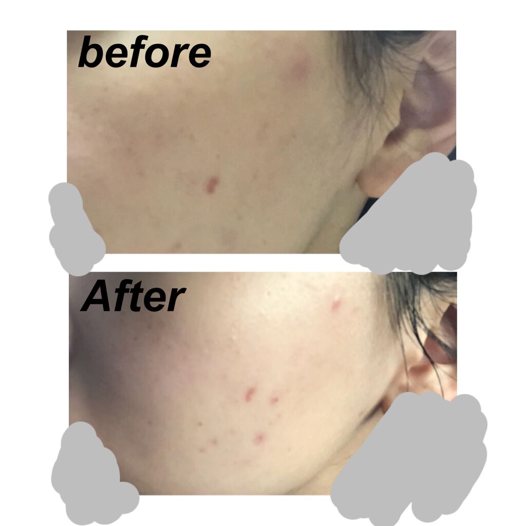 マデカソ CICAクリーム  /A’pieu/フェイスクリームを使ったクチコミ(3枚目)