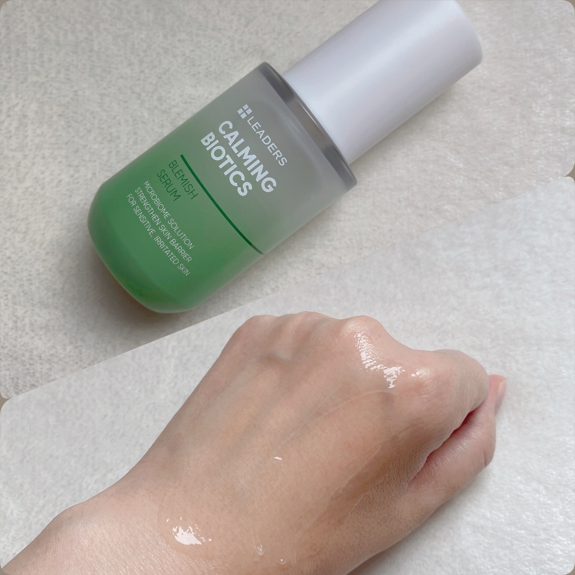 カーミングバイオテックスブレミッシュセラム/LEADERS/美容液を使ったクチコミ（2枚目）
