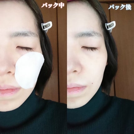 ウォーターモイスチャーアップパッド/Sugar Lab/トナーパッドを使ったクチコミ(6枚目)