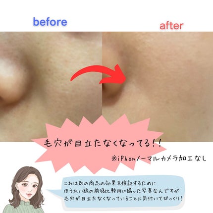 ダヴ 吸着毛穴ケア 洗顔ジェル/ダヴ/その他洗顔料を使ったクチコミ(4枚目)