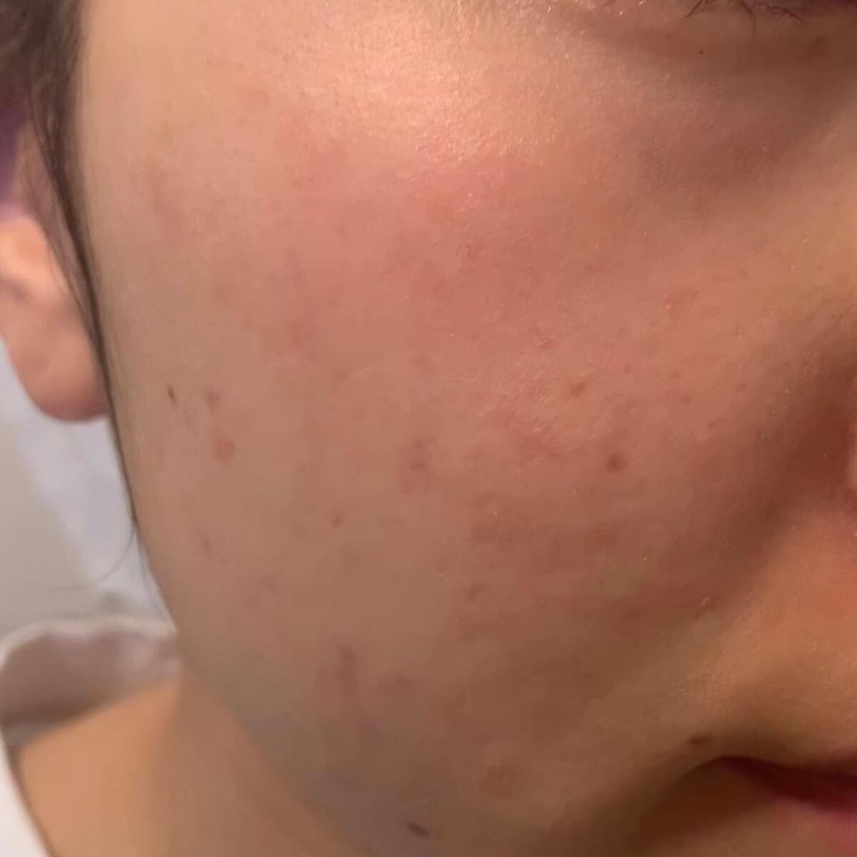 skinmarche WAOPLUS ハートリーフマグワートブースターマスク/ブレーンコスモス/洗い流すパック・マスクを使ったクチコミ(3枚目)