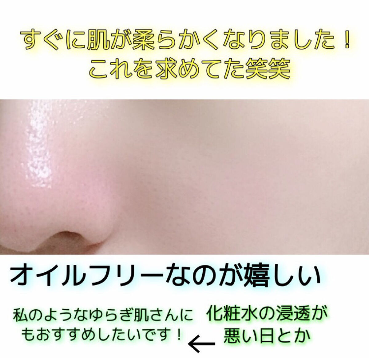 薬用スキンコンディショナー/オードメディカ/ボディローションを使ったクチコミ（3枚目）