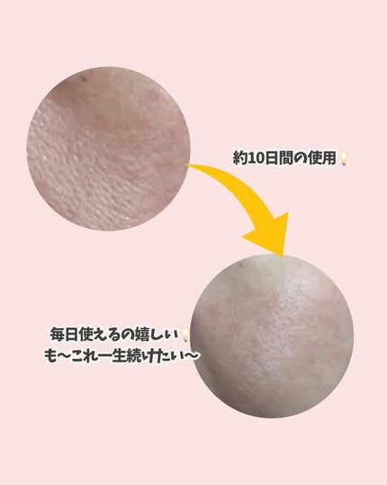 ゼロ1DAYエクソソームショット2000/MEDICUBE/美容液を使ったクチコミ(6枚目)