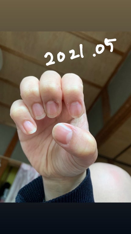 エテュセ クイックケアコート/ettusais/ネイルオイル・トリートメントを使ったクチコミ(4枚目)