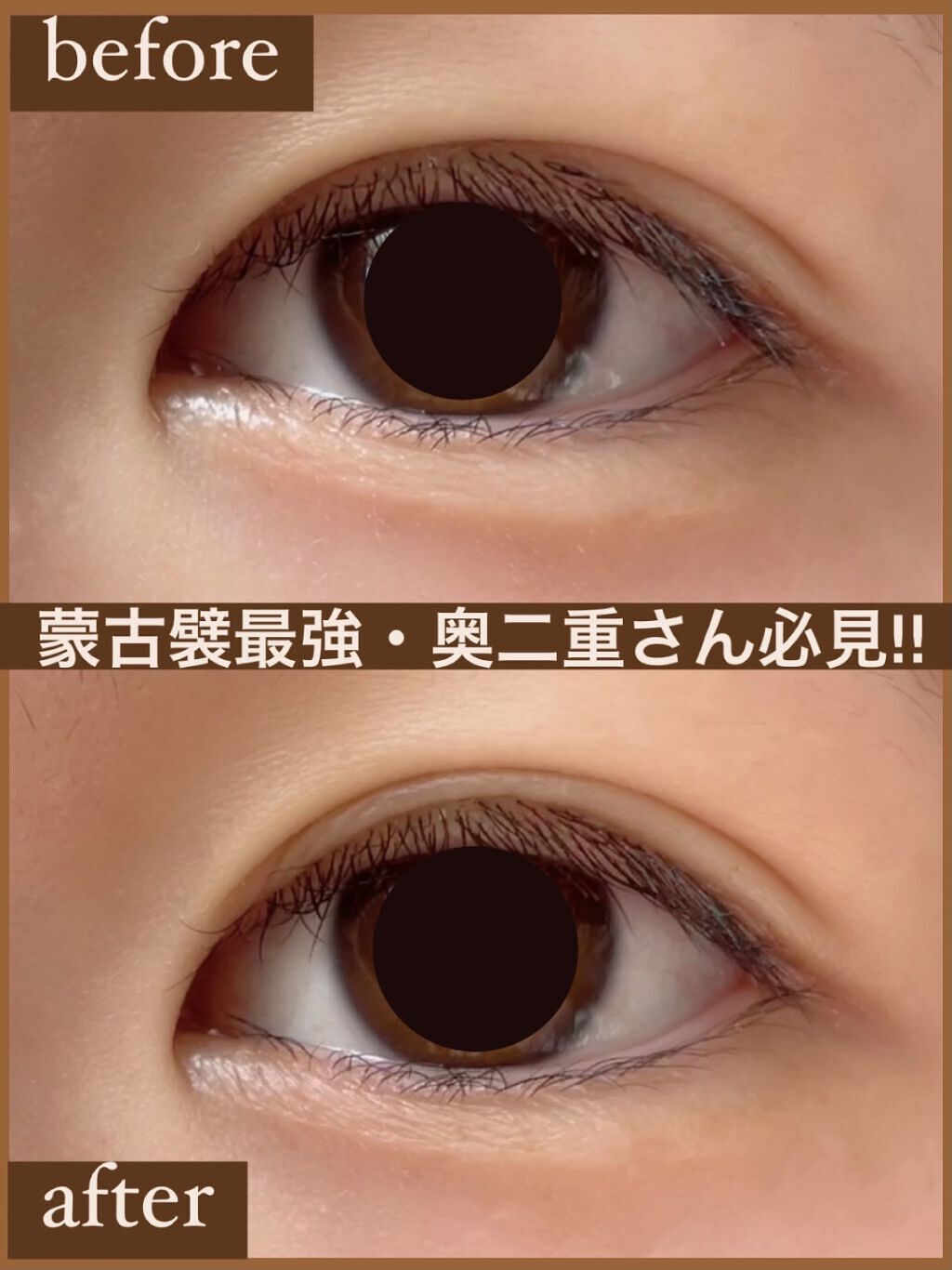 アイテープ 埋没式両面テープ/DAISO/二重まぶた用アイテムを使ったクチコミ（1枚目）