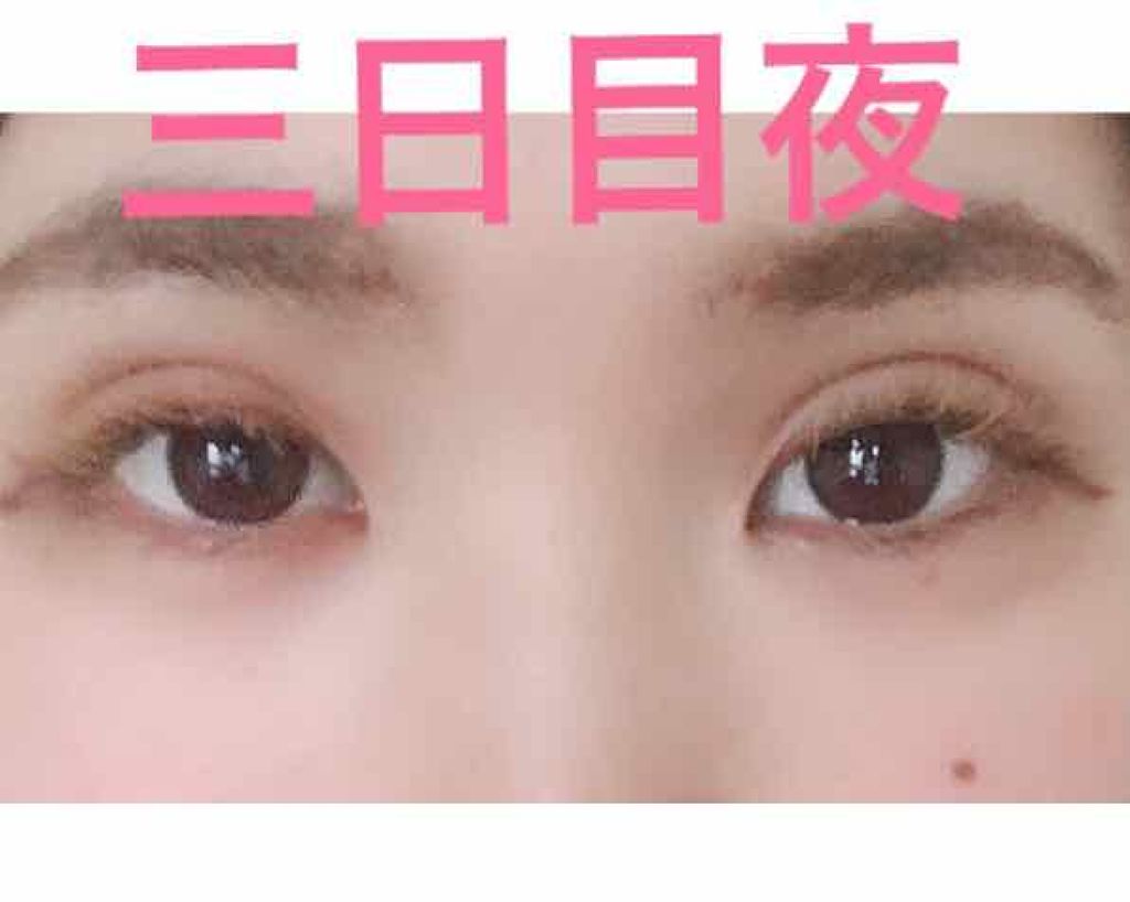 ðçå§«ðŸ on LIPS ãã ãã¶èªç¶ã«ãªã£ãŠããæ°ãããŸãå
åºè¡ã®èµ€ã¿ãã ãã¶ã²ããŸãã..ãïŒ2æç®ïŒ