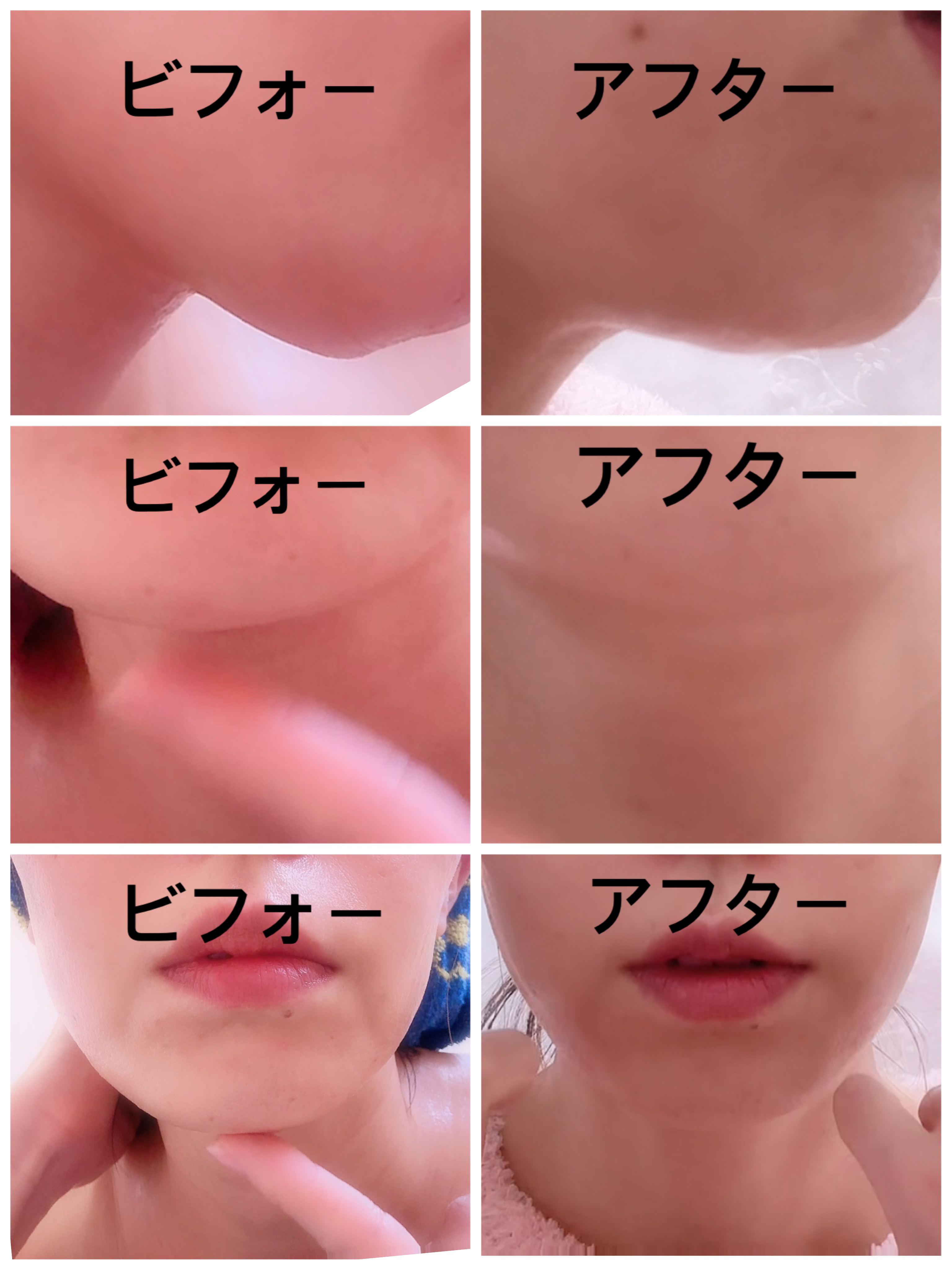 9番 NMNバイオリフトラッピングマスク/numbuzin/シートマスク・パックを使ったクチコミ（2枚目）