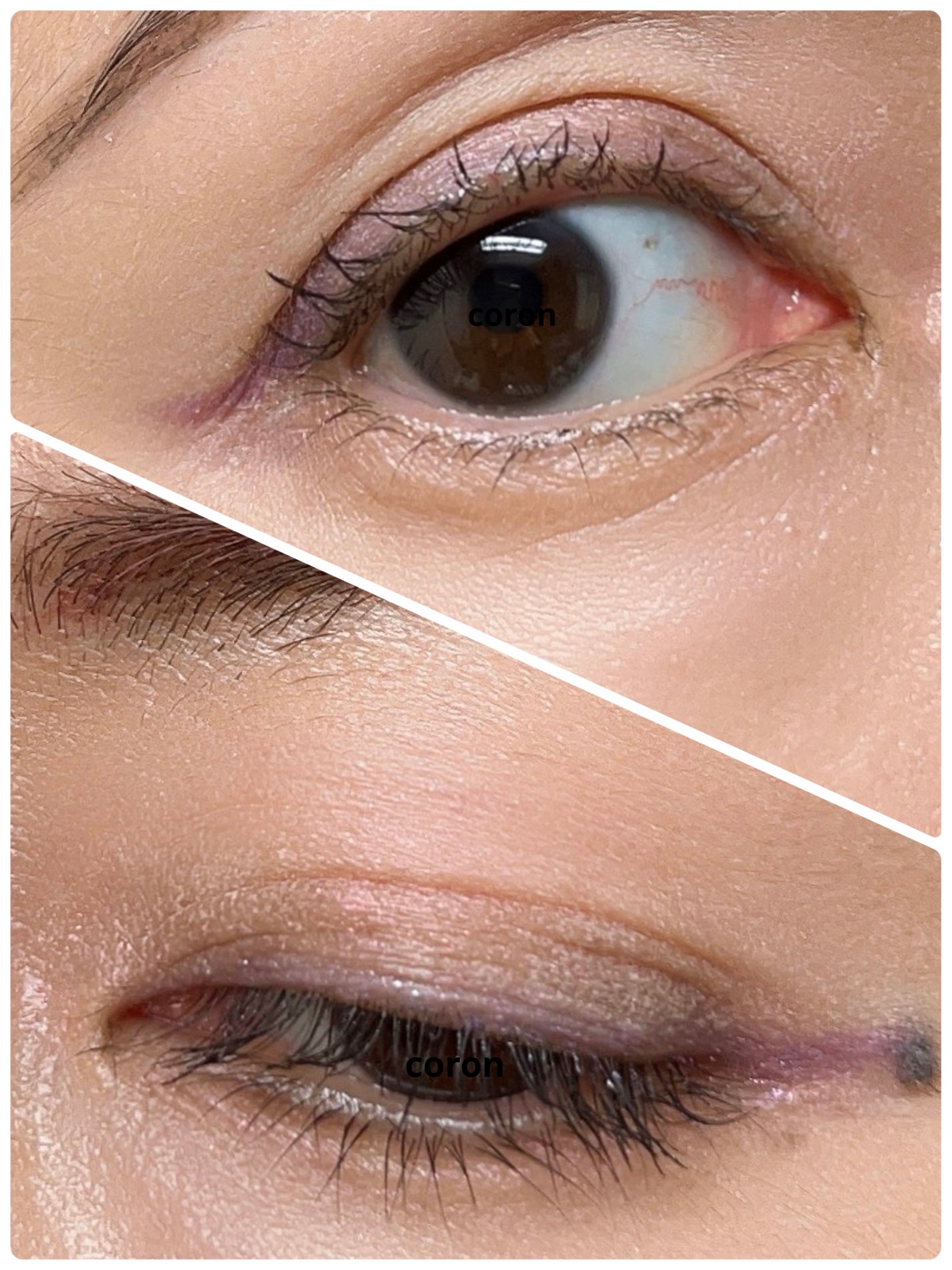 ãã³ã°ïŒã«ãŒã«ãã¹ã«ã© ã¢ããã³ã¹ããã£ã«ã /ããã€ã³ã¡ã€ã¯/ãã¹ã«ã©ã䜿ã£ãã¯ãã³ãïŒ2æç®ïŒ