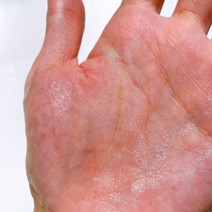 ナイアシンアミドグルタチオントナー/ONE THING/化粧水を使ったクチコミ(4枚目)