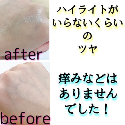 スターターセット/SOPHISTANCE/トライアルキットを使ったクチコミ(7枚目)