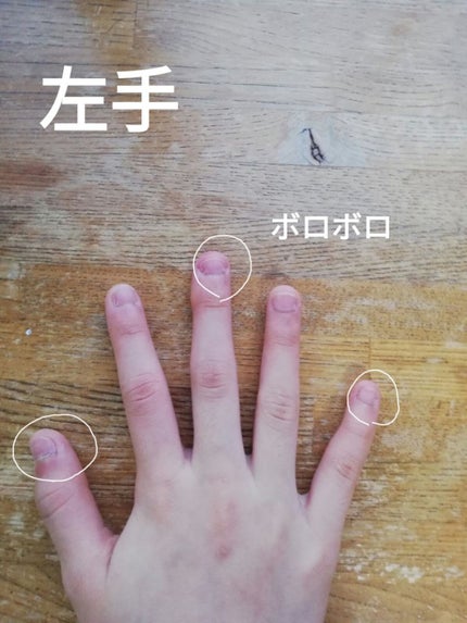 デイケアオイル/Dr.Nail/ネイルオイル・トリートメントを使ったクチコミ(3枚目)