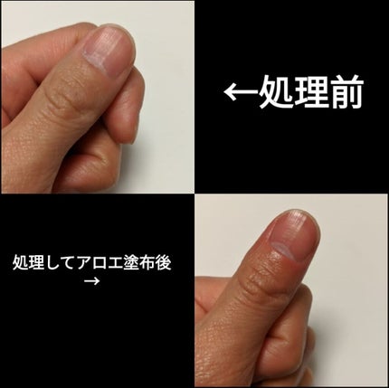 「間宮」アロエ軟膏 (医薬品)/アロエ製薬/その他を使ったクチコミ(1枚目)