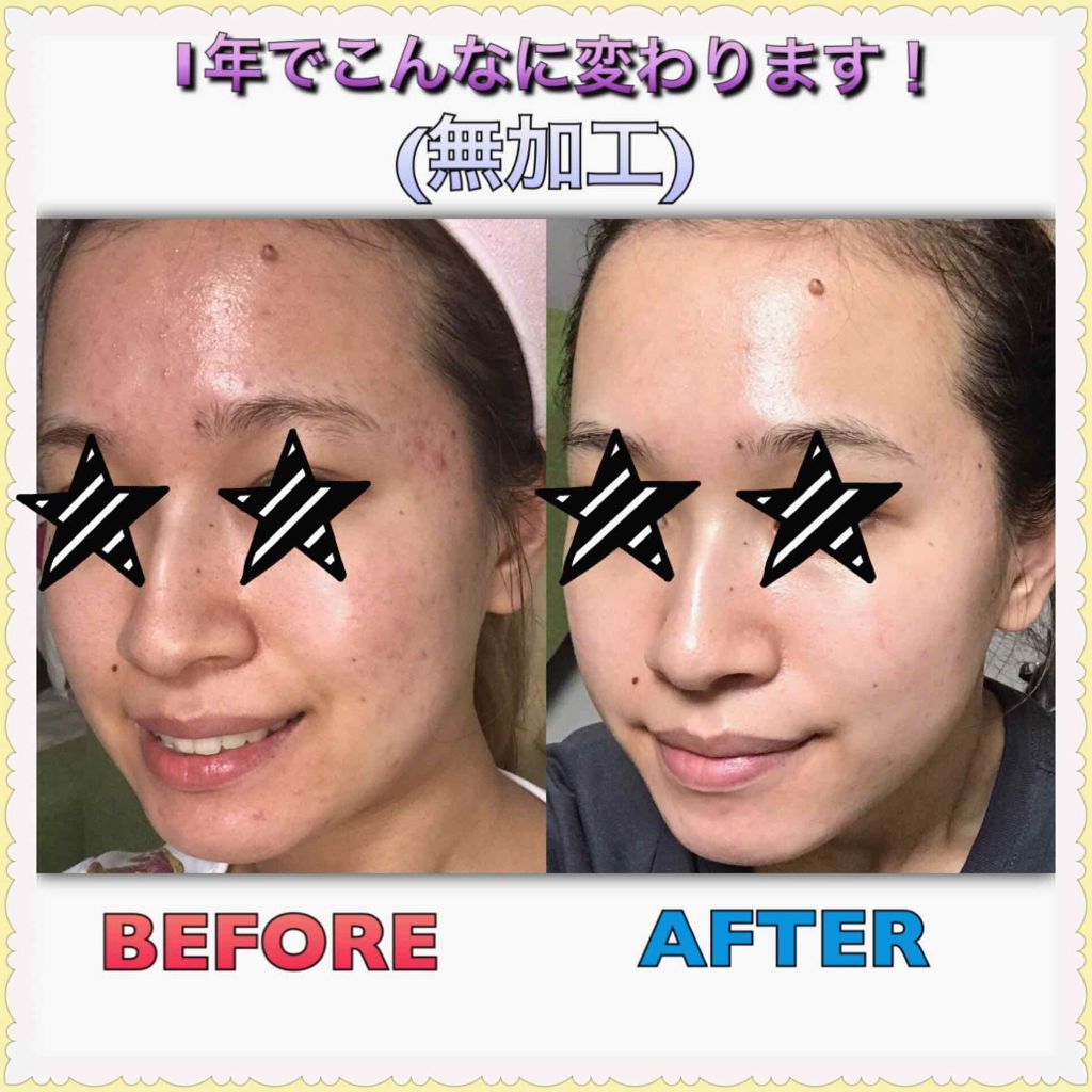 ハイドラ アクア スキン ローション/アーティストリー/化粧水を使ったクチコミ（1枚目）