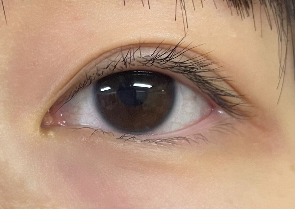 オリシキ アイリッドスキンフィルム /D-UP/二重まぶた用アイテムを使ったクチコミ(2枚目)