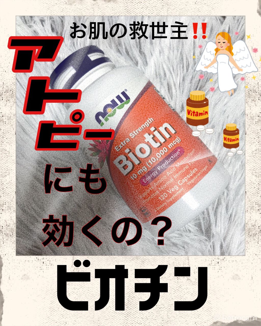 ビオチン/Now Foods/健康サプリメントを使ったクチコミ(1枚目)