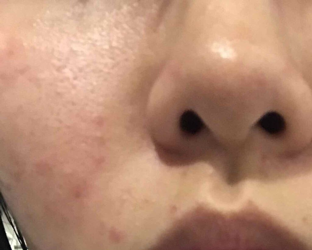 化粧水 ノンアルコールタイプ/ちふれ/化粧水を使ったクチコミ（2枚目）