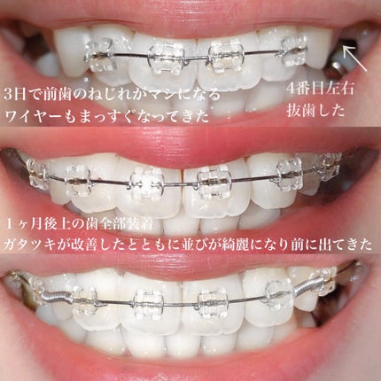 を使ったクチコミ(3枚目)