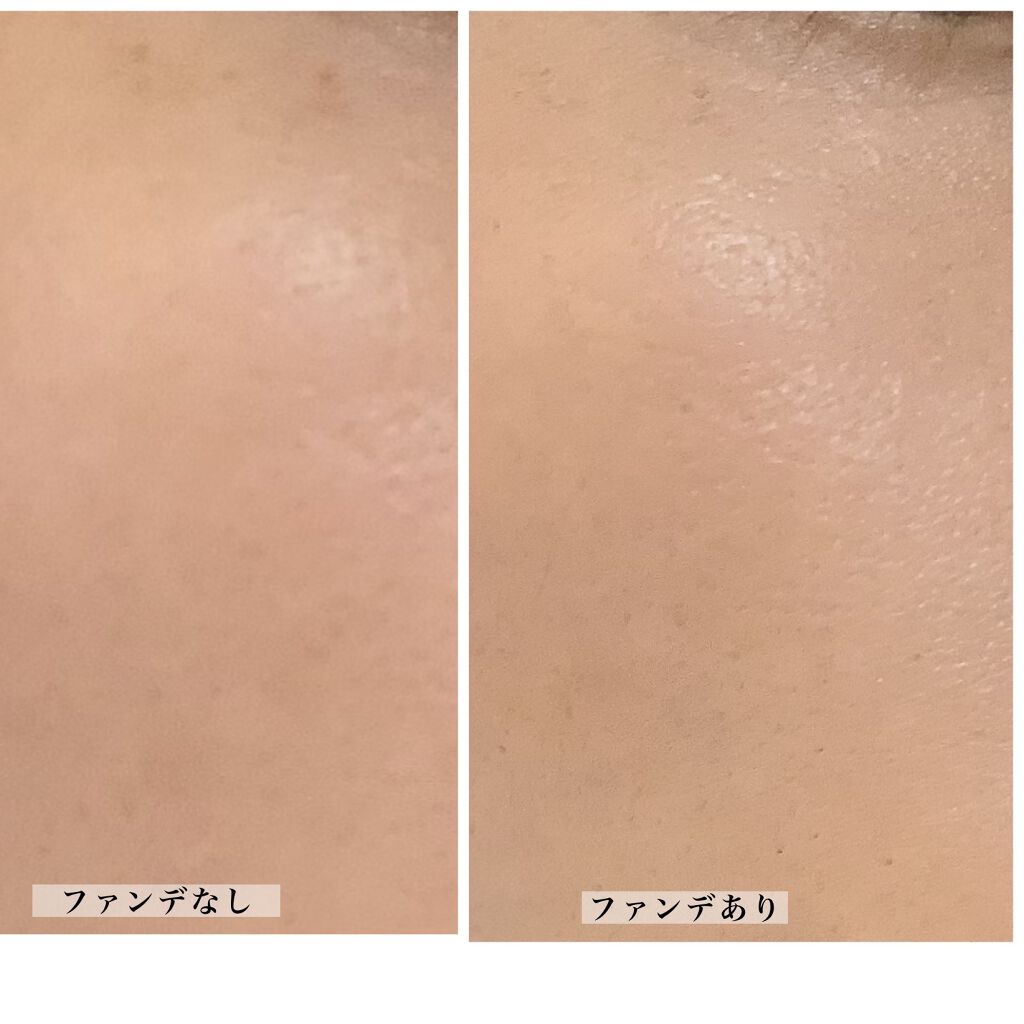 スキンリフレクト ラスティング UV クッションファンデーション 004 Pure Beige/ADDICTION/クッションファンデーションを使ったクチコミ（3枚目）