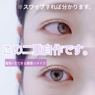 生まれつきの一重です。
今は二重の線ついて、調子の悪い日以外は
なにもしなくても二重に🥺
今回は

🦋変化の過程（飛ばしてもいいかもです）
🦋二重の仕方
🦋使ったもの

をご紹介します。

ー整形せずに