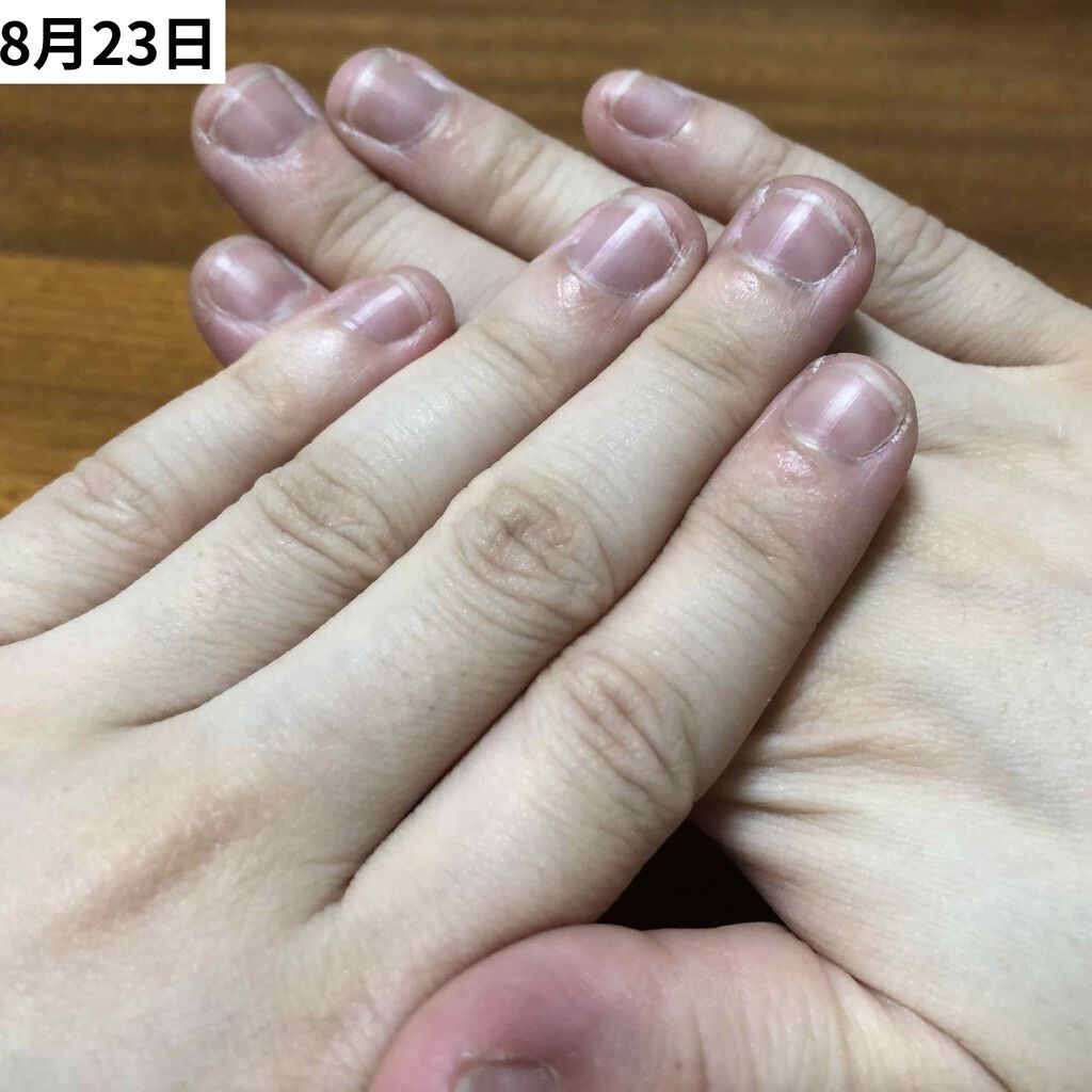 エテュセ クイックケアコート/ettusais/ネイルオイル・トリートメントを使ったクチコミ(2枚目)