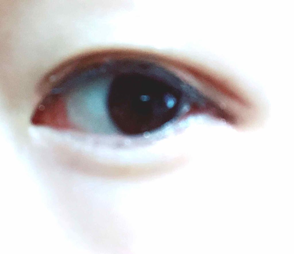 絆創膏/その他を使ったクチコミ（2枚目）