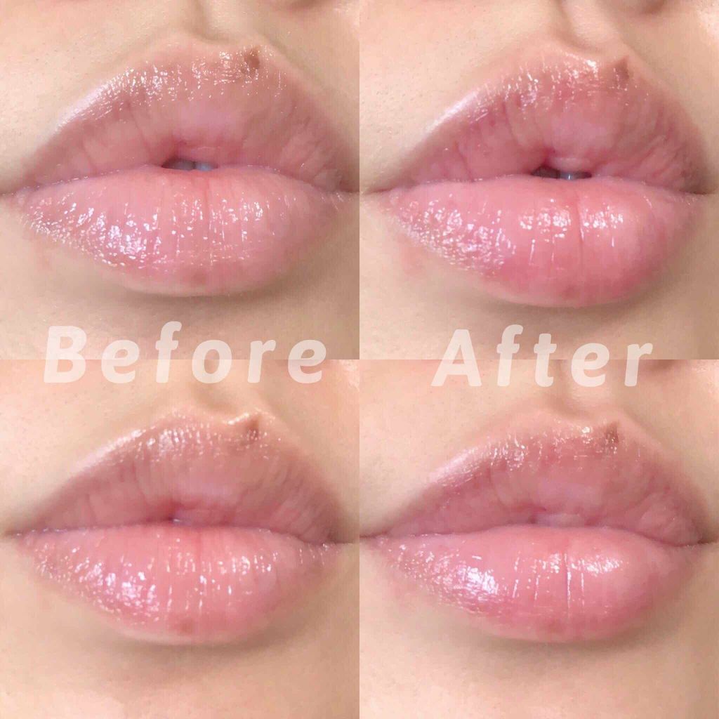 フルリップス Fullips/Fullips/その他化粧小物を使ったクチコミ（2枚目）