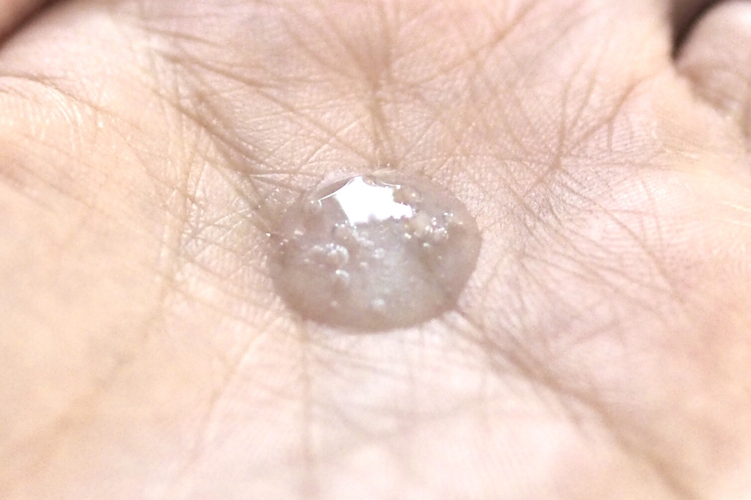 ニードルセラムAZ/fractionalCC/美容液を使ったクチコミ（3枚目）