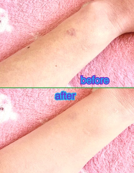 エッセンス ラディアンス クッション/VINNE /クッションファンデーションを使ったクチコミ(6枚目)