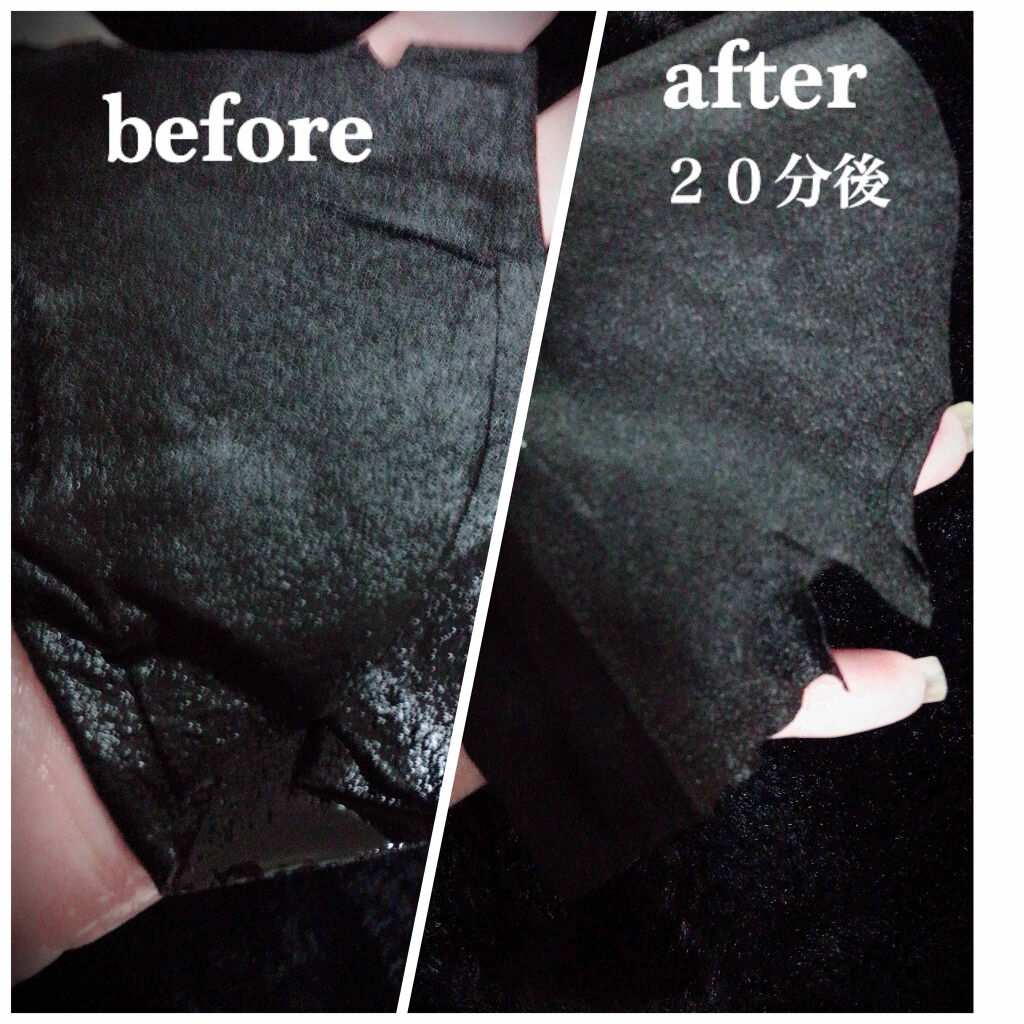 チャコールミネラルブラックアンプルマスク/SNP/シートマスク・パックを使ったクチコミ（3枚目）