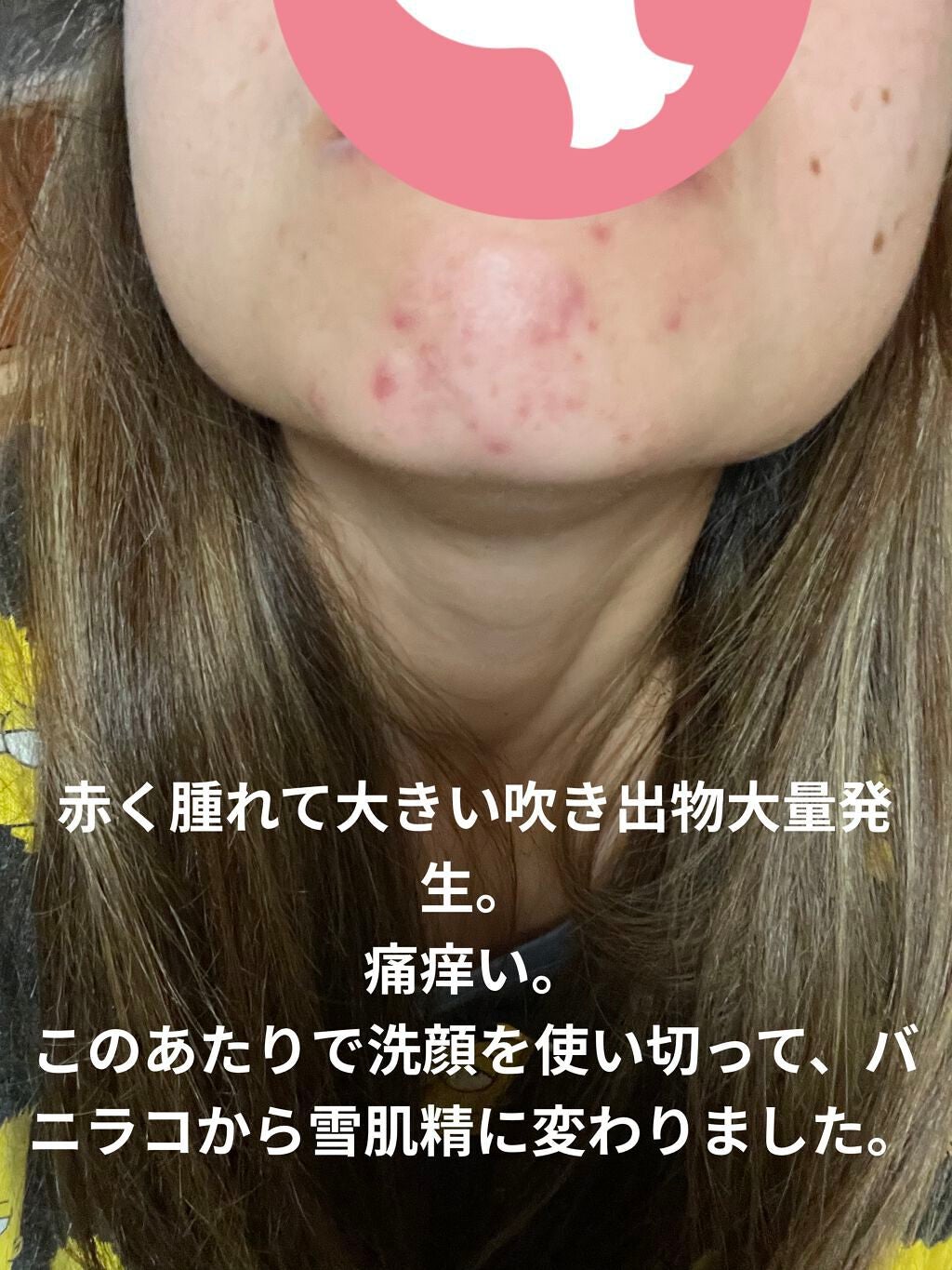 ホワイト クリーム ウォッシュ/雪肌精/洗顔フォームを使ったクチコミ(1枚目)