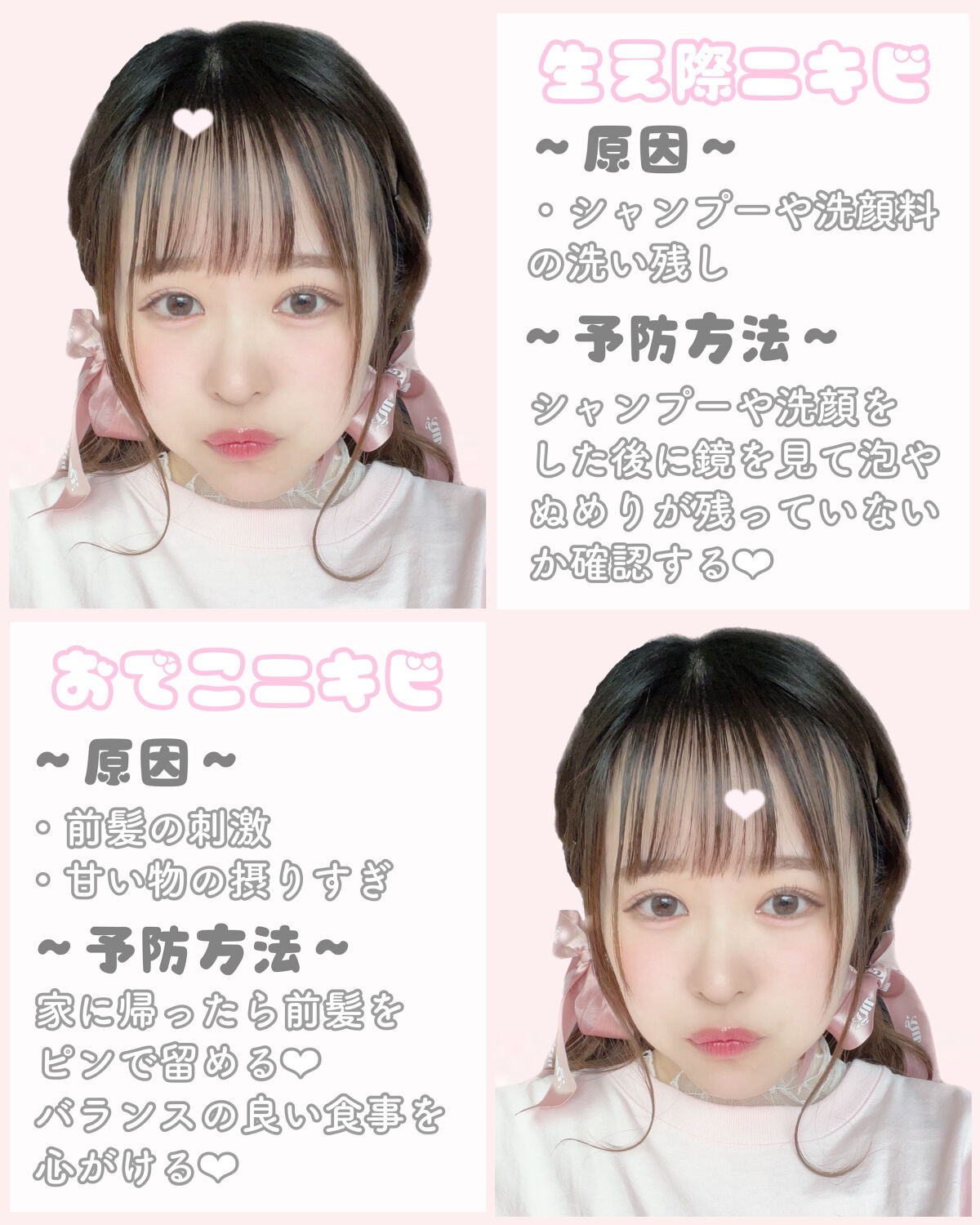 ごめんね素肌 キニナルマスク/クリアターン/シートマスク・パックを使ったクチコミ（2枚目）